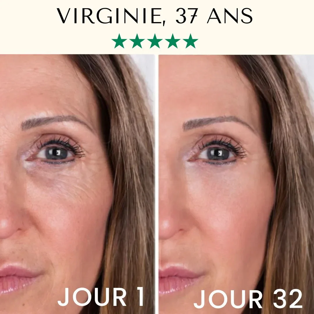 Appareil de nettoyage du visage à ultrasons – Image 7