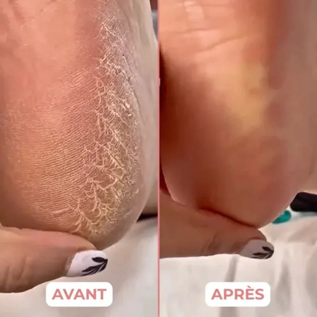 Appareil de pédicure électrique – Image 4