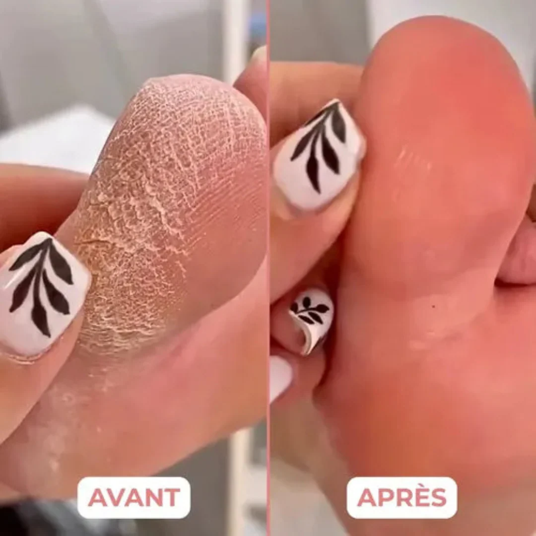 Appareil de pédicure électrique – Image 5