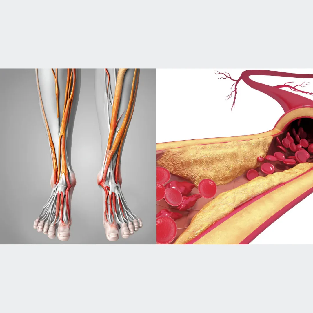 Appareil à vibrations contre la neuropathie – Image 4