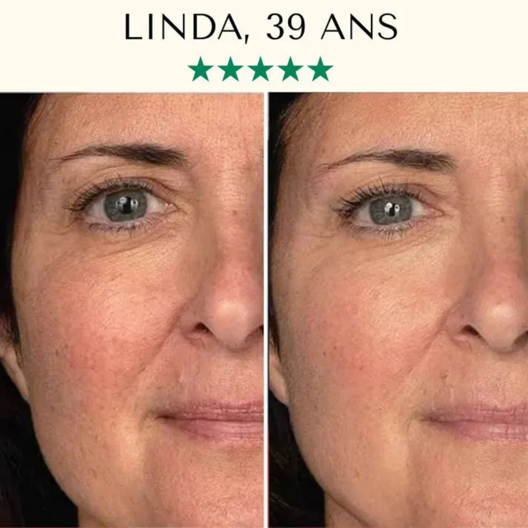 Appareil de nettoyage du visage à ultrasons – Image 6