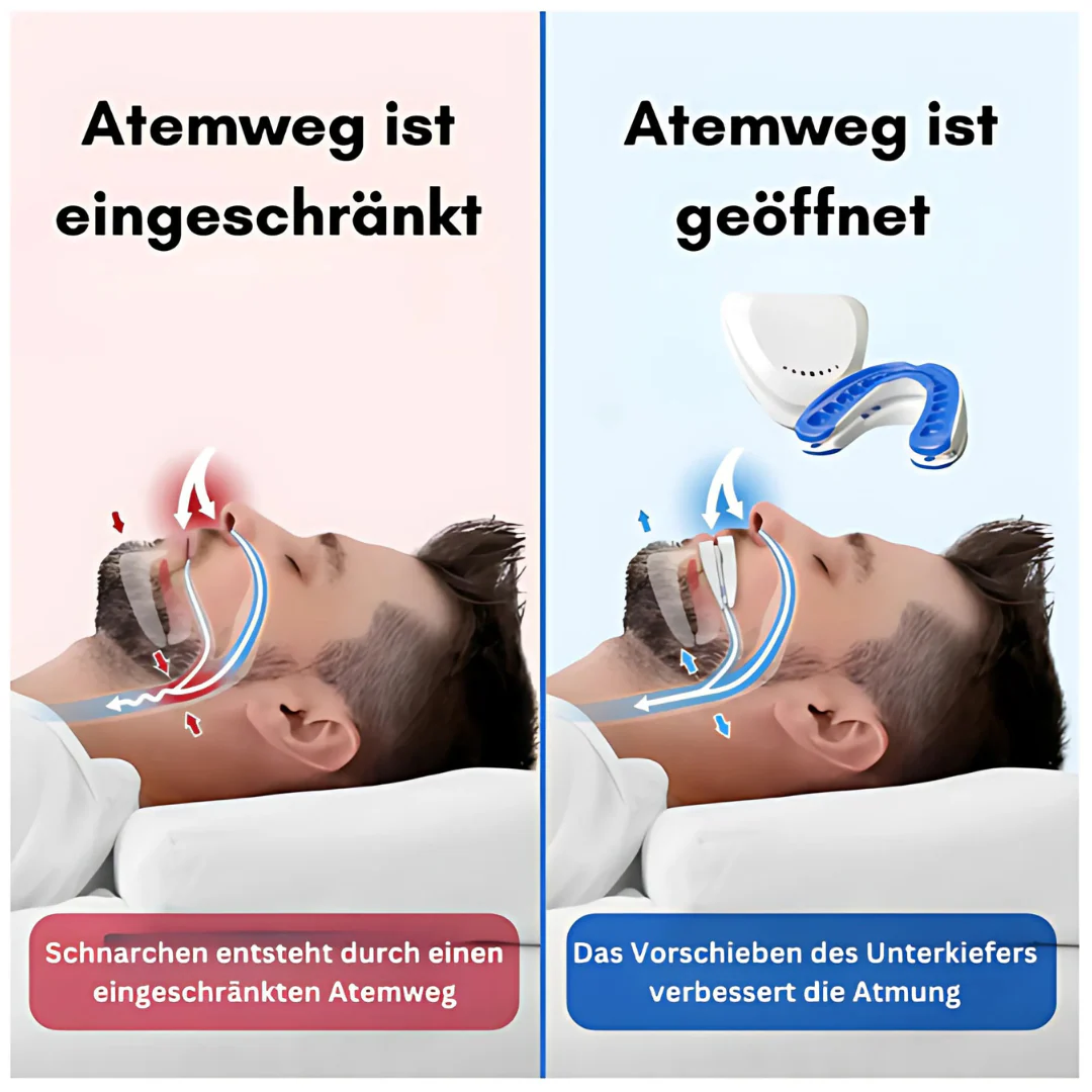 Anti-Schnarchschiene – Image 5