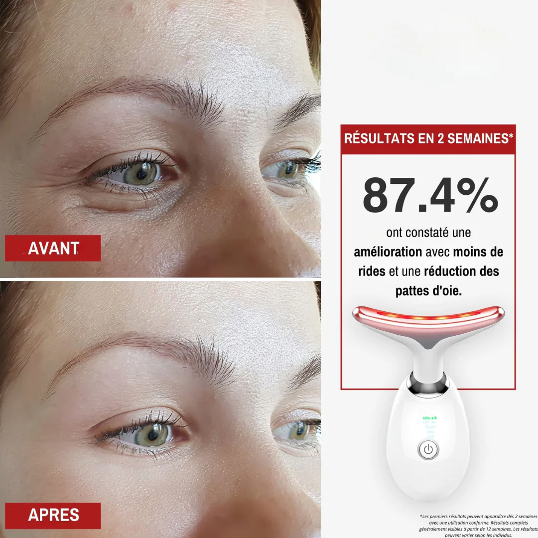 Appareil anti-âge pour le visage à lumière LED – Image 8