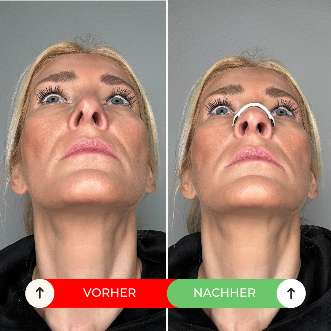 AirBreathe Starter Kit – Image 4