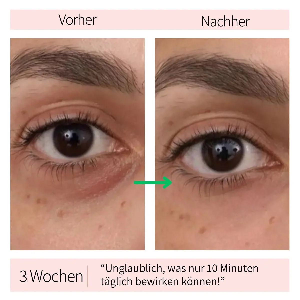 Appareil de massage raffermissant pour les yeux et les poches – Image 2