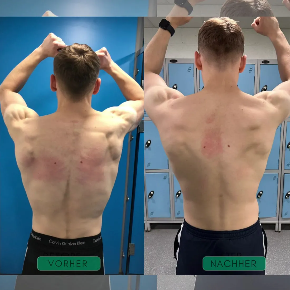 AlignFlex™ Correcteur de posture – Image 3