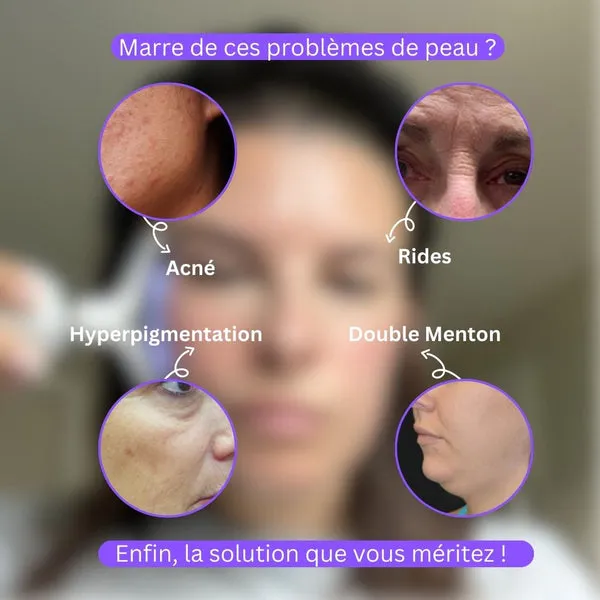 Appareil de lifting visage et cou à microvibrations – Image 4